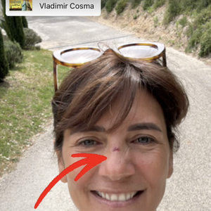 "La porte 1 - Estelle 0", a-t-elle préféré s'en amuser en postant un selfie d'elle en story Instagram.

Estelle Denis se blesse au visage pendant ses vacances avec son compagnon Marc Thiercelin