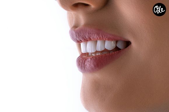 Des gouttières peuvent aussi être proposés aux patients par les dentistes, livrées avec un gel blanchissant. Elles sont à porter quotidiennement pendant 1 à 2 semaines pour un effet progressif et de longue durée comparé au reste

Comment se blanchir les dents à domicile ?