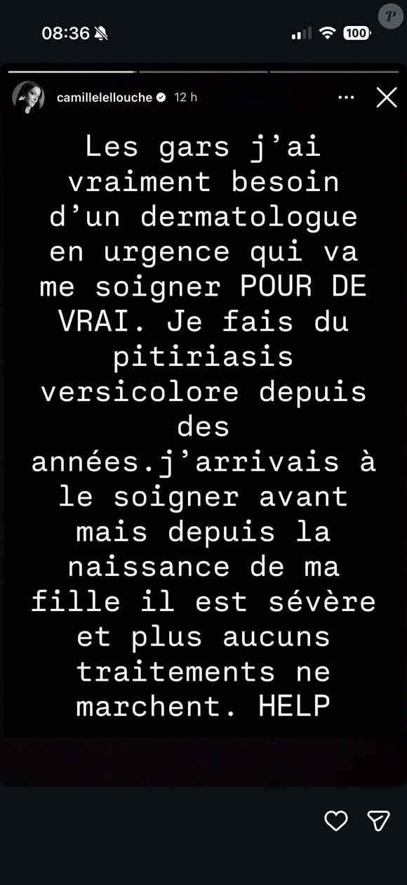 Camille Lellouche demande un dermatologue en urgence ©Instagram