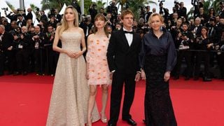 Pour la première fois, cette actrice iconique montre les traces laissées par son opération