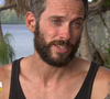 Le but ? Réaliser une greffe de cheveux directement sur la zone accidentée, là où les cheveux refusaient de repousser. 

Cyril lors de l'avant-dernier épisode de "Koh-Lanta, la guerre des chefs" (TF1), vendredi 14 juin 2019.