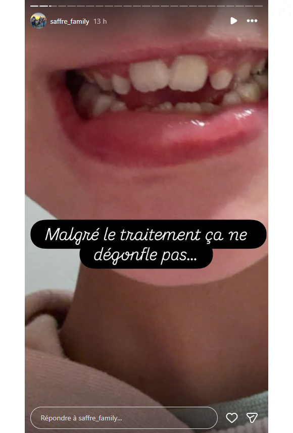 Il a été pris en charge aux urgences.

Céline Saffré (Familles nombreuses) donne des nouvelles de ses enfants.