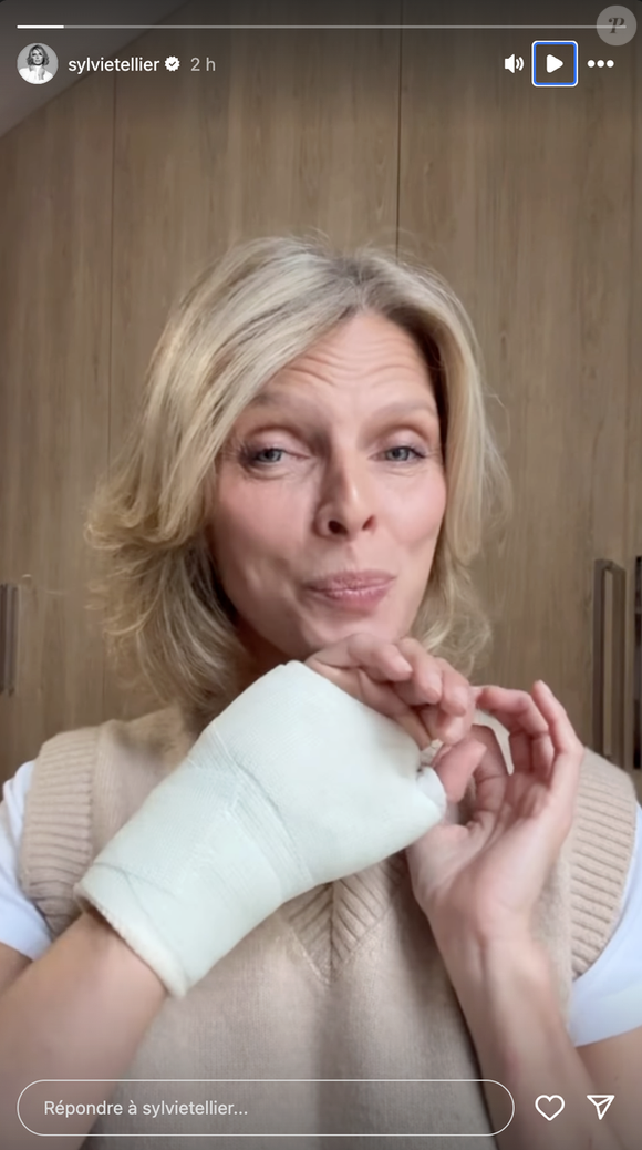 Sylvie Tellier a dévoilé son bras dans le plâtre le mardi 14 octobre 2025 sur Instagram avant de s'exprimer sur les circonstances de sa blessure.
Crédit : Instagram/sylvietellier