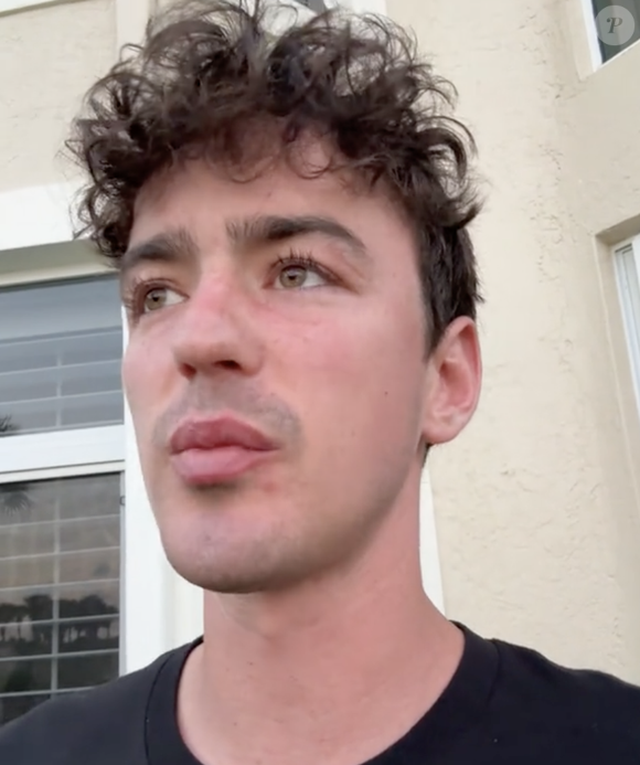 L'influenceur américain Ben Bader est décédé brutalement à l'âge de 25 ans. La terrible nouvelle a été annoncée par sa petite amie, Reem.


Capture d'écran Tiktok de Ben Bader.