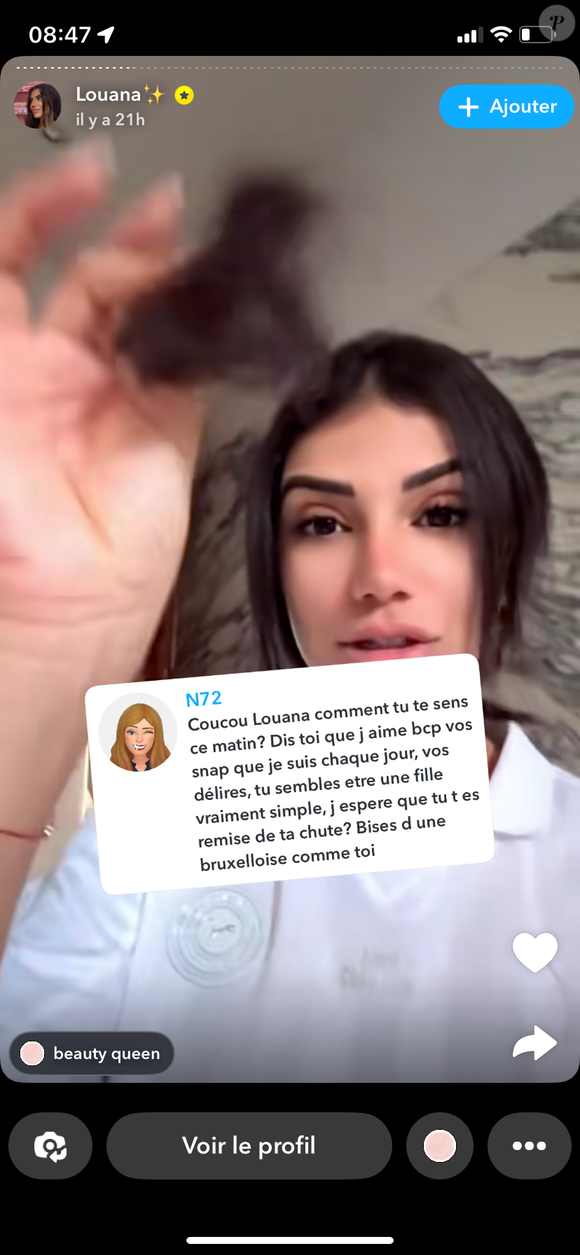 dévoilant au passage des touffes de cheveux qui sont tombées.

Louana Franco révèle avoir perdu beaucoup de cheveux suite à son accident à cheval au Maroc. Snapchat