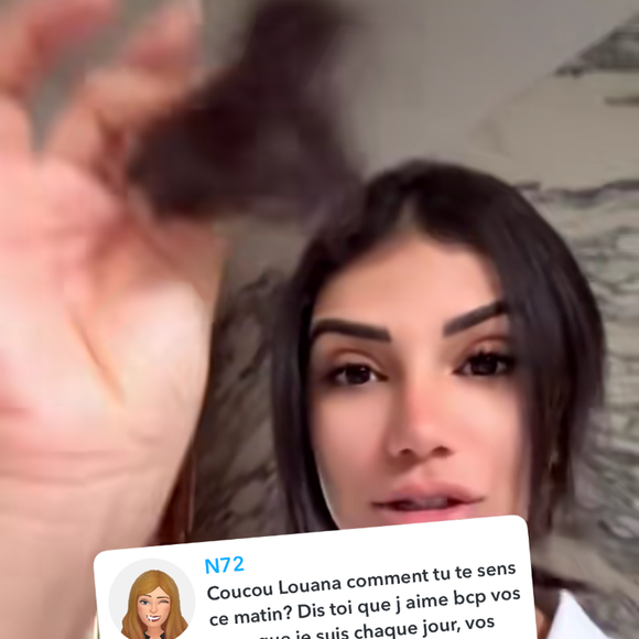 dévoilant au passage des touffes de cheveux qui sont tombées.

Louana Franco révèle avoir perdu beaucoup de cheveux suite à son accident à cheval au Maroc. Snapchat