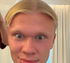 Sur Instagram, il a partagé chaque étape de sa métamorphose capillaire. 

Compte Instagram de Erling Haaland