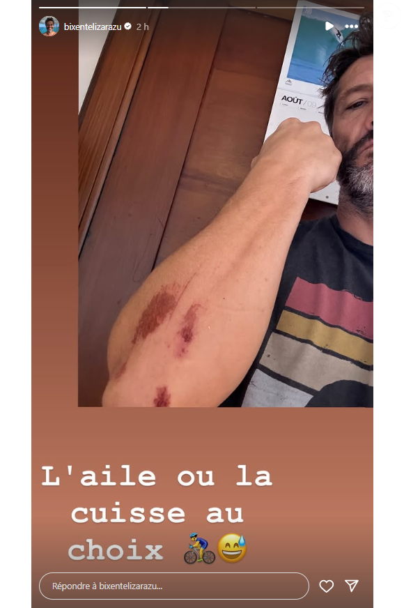et d'autre part son bras égratigné de manière impressionnante également. 

Bixente Lizarazu annonce s'être blessé à vélo.