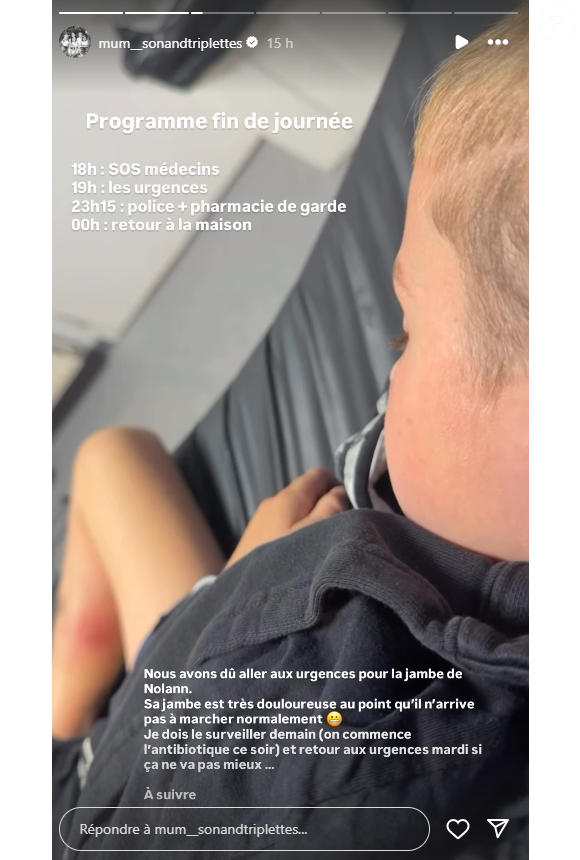 Sur Instagram, elle partage une photo de son fils Nolann, avec une grosse rougeur au niveau du mollet.

Laetitia Provenchère (Familles nombreuses) donne des nouvelles de son fils malade. Sur Instagram le 15 septembre 2025.