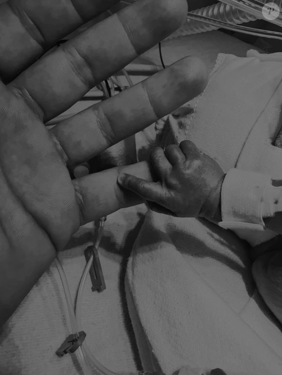 Son frère, Léonard, est né grand prématuré

Agathe Gérin a annoncé sur Instagram la mort d'un des bébés que sa femme portait. L'autre jumeau est né grand prématuré. 21 août 2025