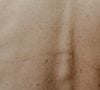 Également appelées "taches de vieillesse", ces taches brunes résultent d'un dérèglement de la mélanine.