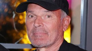 Laurent Baffie a eu recours à plusieurs interventions esthétiques : "l’équivalent d’une fermette en Normandie"