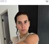 Souailla, la femme de Jimmy Mohamed, partage des images de ses bras couverts de bleus.