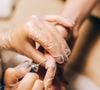 Bien que considérées comme inesthétiques, ces petites peaux jouent pourtant un rôle protecteur fondamental.
Photo : Pexels/leeloothefirst