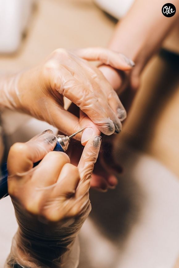 Bien que considérées comme inesthétiques, ces petites peaux jouent pourtant un rôle protecteur fondamental.
Photo : Pexels/leeloothefirst