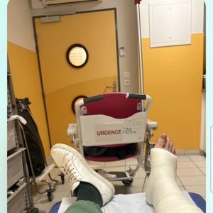 Il a également montré des clichés de son passage aux urgences
Vianney dévoile les coulisses de son passage aux urgences après son accident