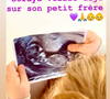 Elle attend son deuxième enfant.

Sonia Mabrouk annonce être enceinte de son deuxième enfant, le 26 novembre 2025 sur Instagram.