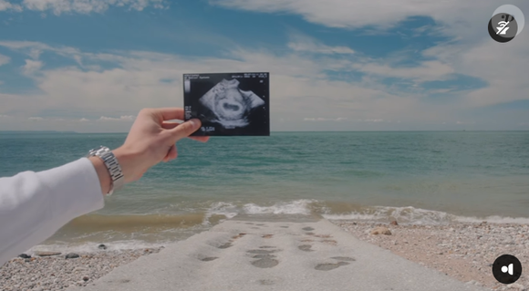 Thomas (Koh-Lanta Fidji) et sa compagne attendent un heureux événement