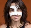 Dans un témoignage poignant, elle s'est livrée sur son passé d'ancienne toxicomane et sur les ravages physiques durables causés par sa consommation de cocaïne.

Sandra Sisley au photocall du village lors des Internationaux de France de Tennis de Roland Garros 2026, à Paris, France, le 5 juin 2026. © Jacovides-Moreau/Bestimage