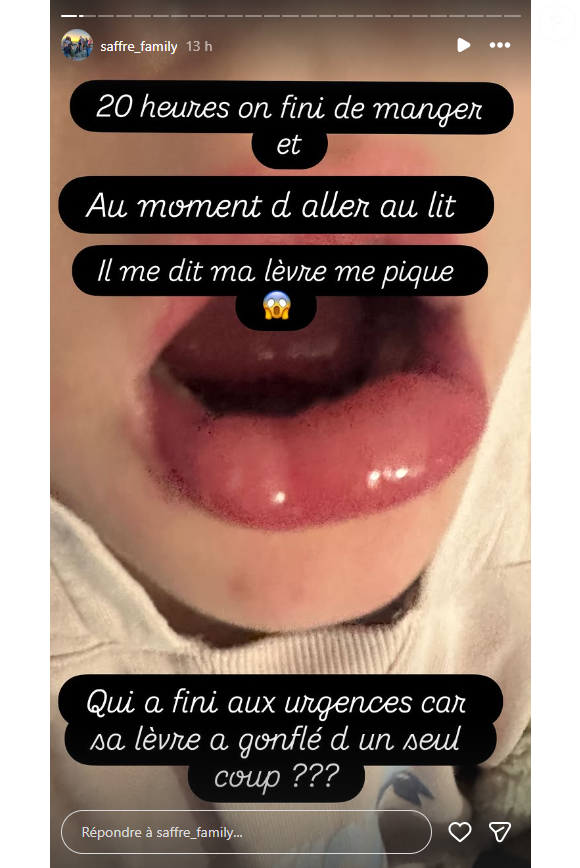 Marcel, le fils de 7 ans de Fabrice et Céline Saffré, a eu la lèvre qui a gonflé après la dîner.

Céline Saffré (Familles nombreuses) donne des nouvelles de ses enfants.