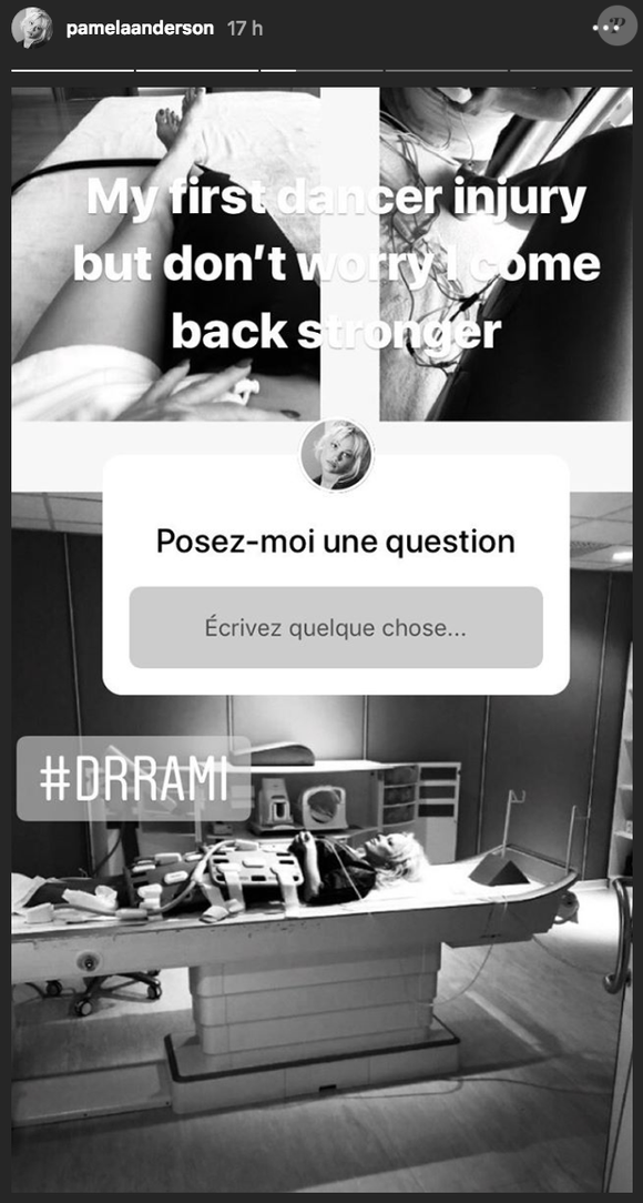 Pamela Anderson se confie sur ses blessures après ses premières répétitions dans "Danse avec les stars 9" sur Instagram le 16 septembre 2018.