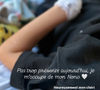 Il avait en réalité attrapé un staphylocoque sur cette plaie, ce qui l'empêchait de marcher normalement.

Laetitia Provenchère (Familles nombreuses) donne des nouvelles de son fils Nolann hospitalisé.