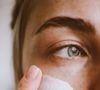 Des facteurs liés à l'hygiène de vie, comme un régime trop riche en sel ou la déshydratation, favorisent la rétention d'eau sous les yeux.
