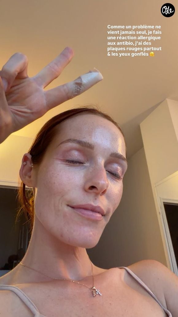 L’ancienne Miss France avait été hospitalisée après l’infection de points de suture à un doigt.

Maeva Coucke a donné de ses nouvelles à ses abonnés. Capture d'écran Instagram