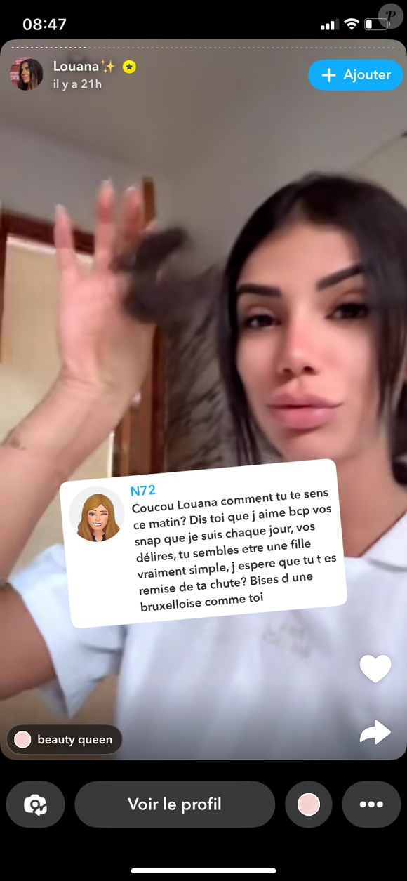 "Je suis tombée, j'étais en état de choc, et ce qui m'a le plus choquée c'est la quantité de cheveux que j'ai perdu, vous n'imaginez pas. Je pense qu'avec l'impact, ma tête a frappé et glissé", explique-t-elle

Louana Franco révèle avoir perdu beaucoup de cheveux suite à son accident à cheval au Maroc. Snapchat
