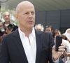 Malgré la gravité de son état, il n’a pas conscience de sa maladie (anosognosie), ce qui est un soulagement pour ses proches.

Bruce Willis - Photocall du film "Moonrise Kingdom" pendant le 65ème Festival du films de Cannes en mai 2012. Photo BORDE-MOREAU / BESTIMAGE