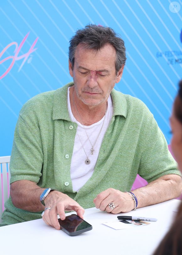 Des analyses ont été demandées.

Jean-Luc Reichmann - Photocall de "Demain nous appartient" (DNA) lors du 64ème Festival de Télévision de Monte Carlo au Grimaldi Forum de Monaco le 14 juin 2025.
© Denis Guignebourg / Bestimage