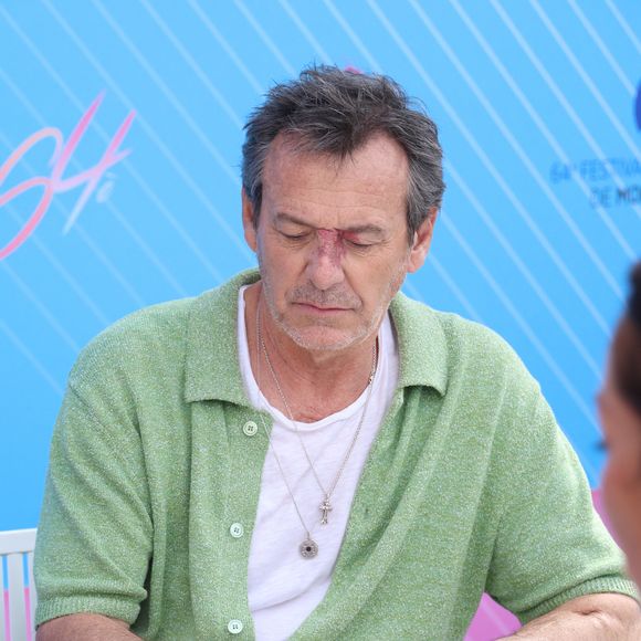 Des analyses ont été demandées.

Jean-Luc Reichmann - Photocall de "Demain nous appartient" (DNA) lors du 64ème Festival de Télévision de Monte Carlo au Grimaldi Forum de Monaco le 14 juin 2025.
© Denis Guignebourg / Bestimage