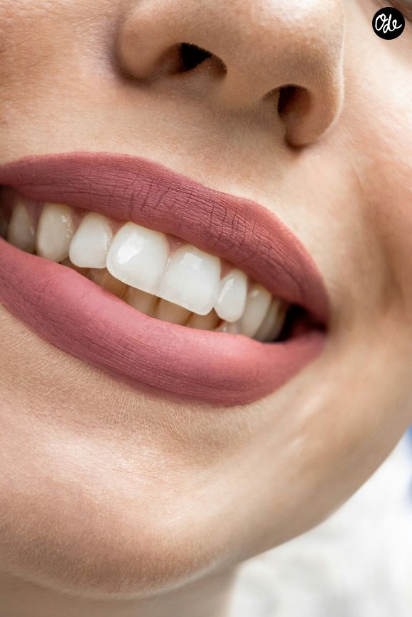 Comment se blanchir les dents à domicile ?