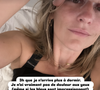 Après quoi, la jeune femme a partagé une photo d'elle où il est possible de voir les premiers résultats sur ses paupières. 

Laure (Mariés au premier regard) donne des nouvelles après ses opérations.