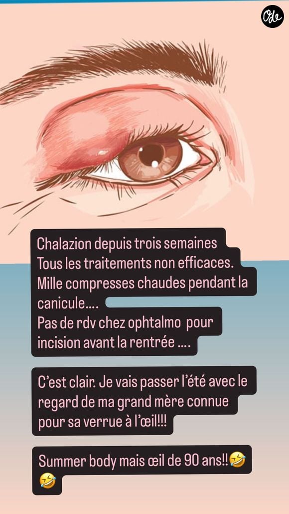 Elle a révélé souffrir d’un chalazion à l’œil droit depuis plusieurs semaines et les traitements ne fonctionnent pas

Faustine Bollaert sur Instagram