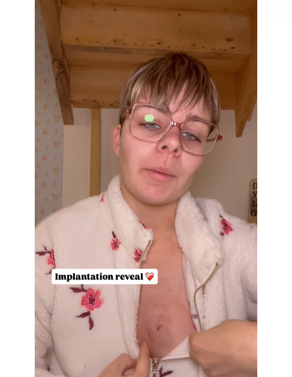 Perrine (L'amour est dans le pré) dévoile son implantation cardiaque.