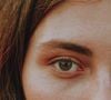 Un test de pincement très simple permet de diagnostiquer soi-même les besoins immédiats de son visage.