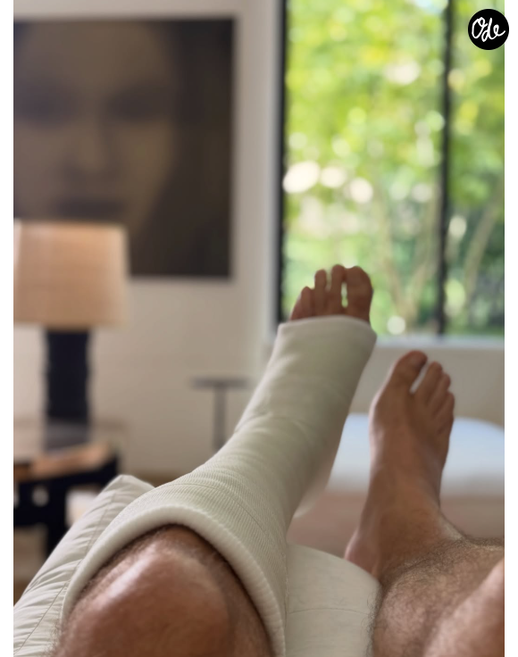 "Ma vie mon Oeuvre épisode 12567", a-t-il écrit avec humour, avant d'ajouter : "Ça aurait pu être pire. Genre pendant une canicule..."

Arthur apparaît sur Instagram le pied et le mollet dans le plâtre