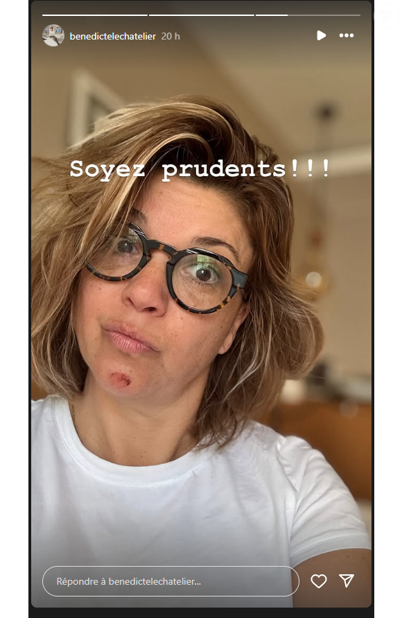 Elle a demandé à ses abonnés qui font du ski de rester prudents
Bénédicte Le Chatelier a été victime d'un accident de ski