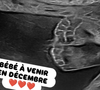 On y aperçoit les petits pieds du futur bébé.

Capture d'écran de Jauffrey sur Instagram