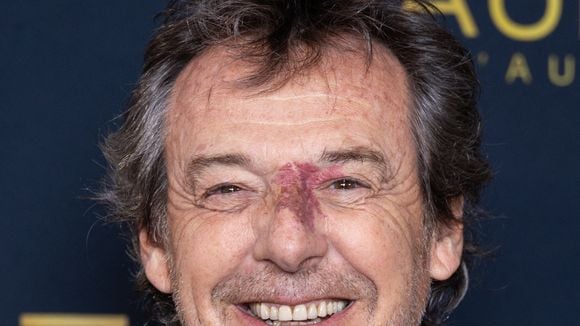 Même sourire et même regard... Jean-Luc Reichmann partage une rare photo avec son frère et sa sœur