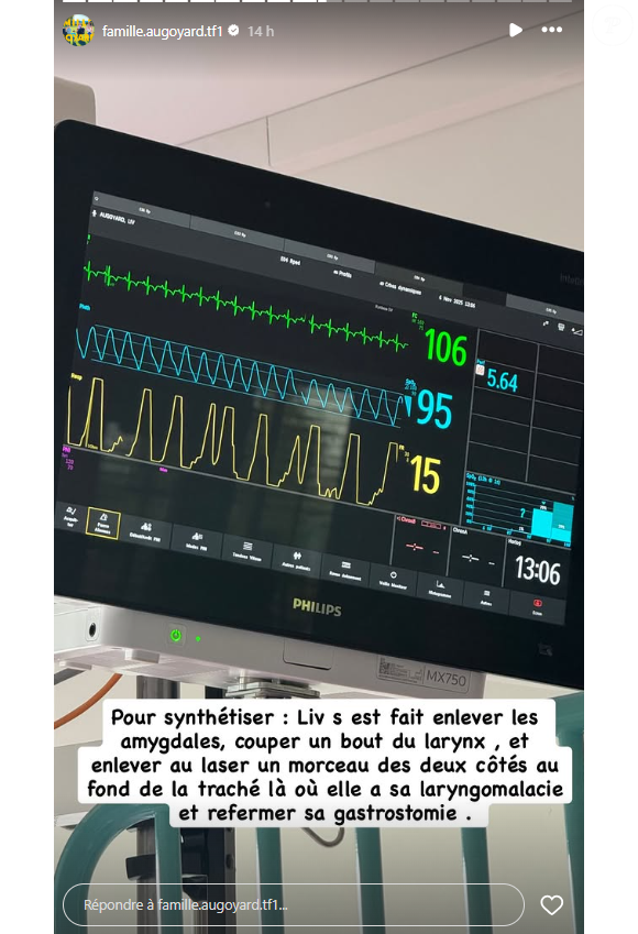 "Pour synthétiser : Liv s'est fait enlever les amygdales, couper un bout du larynx, et enlever au laser un morceau des deux côtés au fond de la trachée, là où elle a sa laryngomalacie et refermer sa gastrostomie", a-t-elle partagé en story.

Roxanne Augoyard donne des nouvelles de sa fille Liv