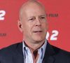 Bruce Willis est atteint d’une démence fronto-temporale, une maladie incurable.

Bruce Willis lors du photocall du film "Red 2" a l'hotel Mandarin Oriental a Munich. Le 24 juillet 2013. Photo API / BESTIMAGE