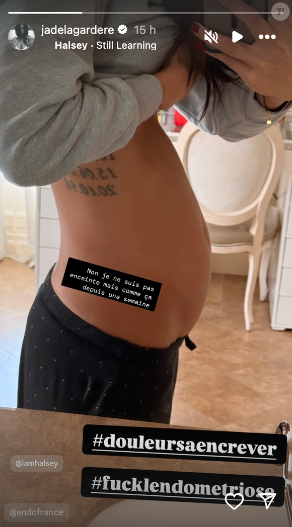 Jade Lagardère dévoile une photo de son corps déformé à cause de l'endométriose sur Instagram le mercredi 5 mars 2025.
Crédit : Instagram/jadelagardere