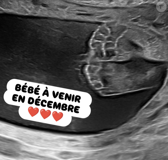 Un petit garçon en bonne santé dont le prénom n'a pas été partagé.

Capture d'écran de Jauffrey sur Instagram
